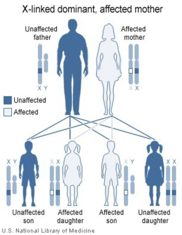 Diagramm eines X-chromosomal dominanten Familienstammbaums mit einer betroffenen Mutter und zugehörigen genetischen Vererbungsinformationen.